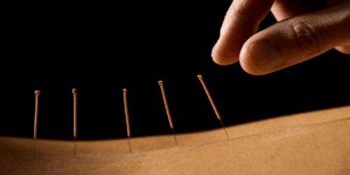 Acupuncture Services Image