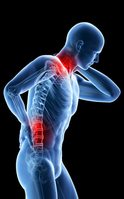 Back and Neck Pain Image